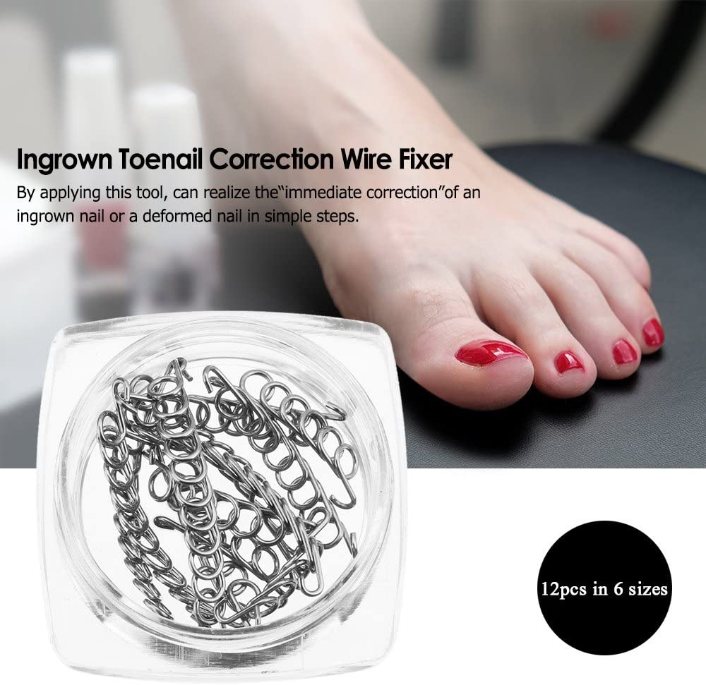 Anself 12Pcs/Box Ingrown Toenail Correction Wire Fixer 6 Sizes Ingrown