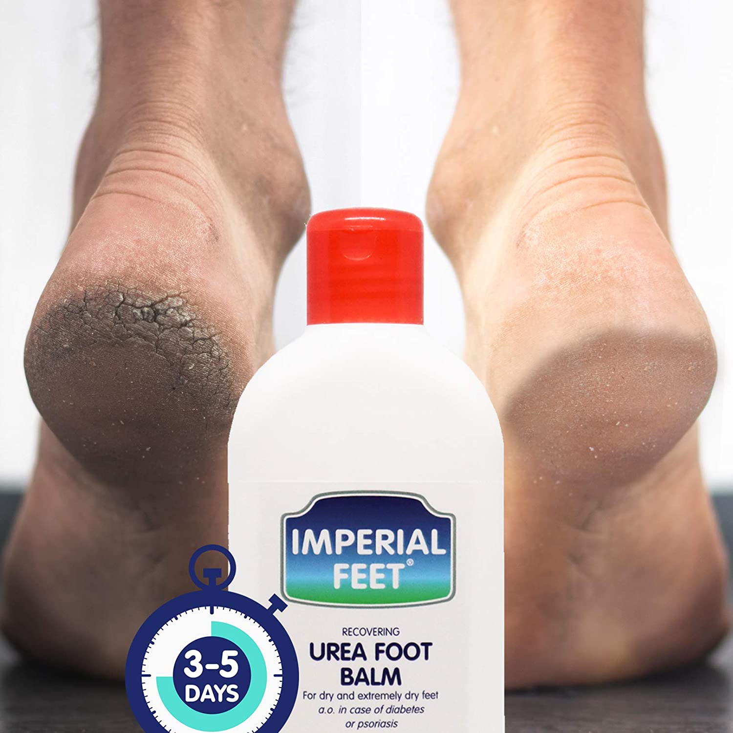 Urea Cream for Cracked Heels & Dry Skin Hand Cream Diabetic Foot