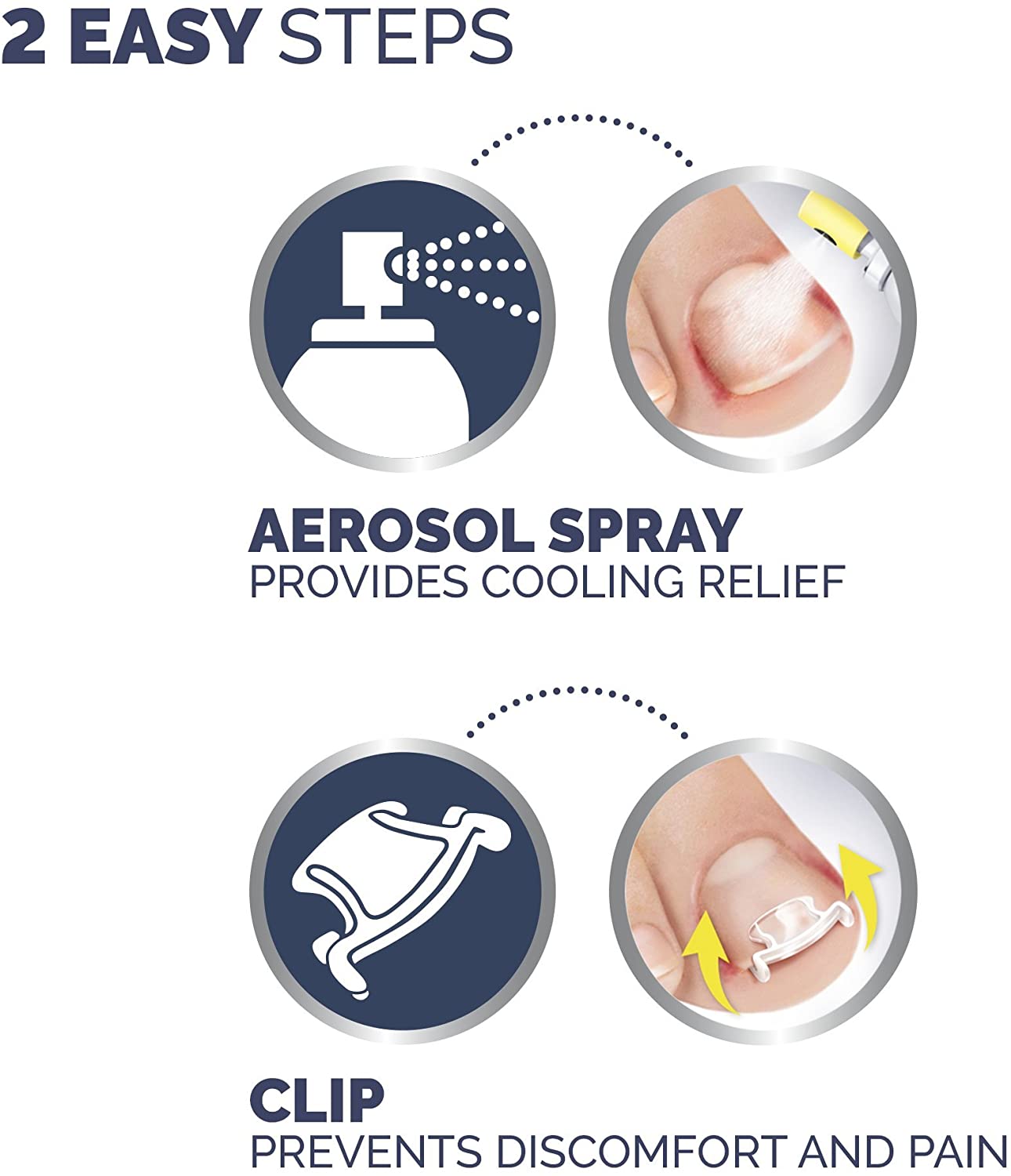 Scholl Ingrown Toenail Treatment Kit BigaMart