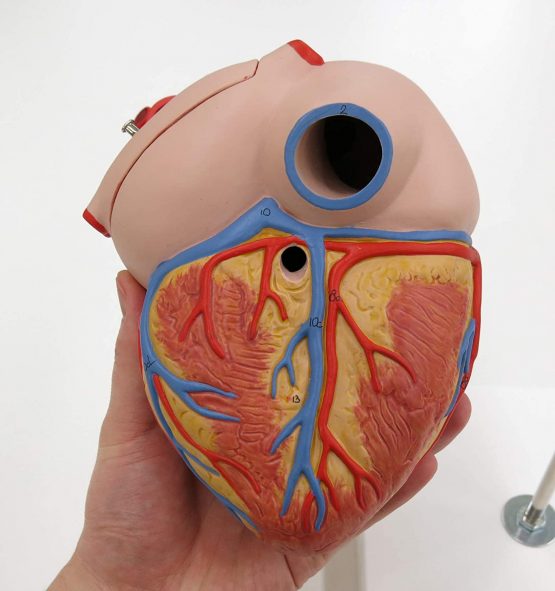 3B Scientific Human Anatomy - Heart Model with Bypass, 2 Times Life Size, 4 Part + free anatomy software - 3B Smart Anatomy - Image 4