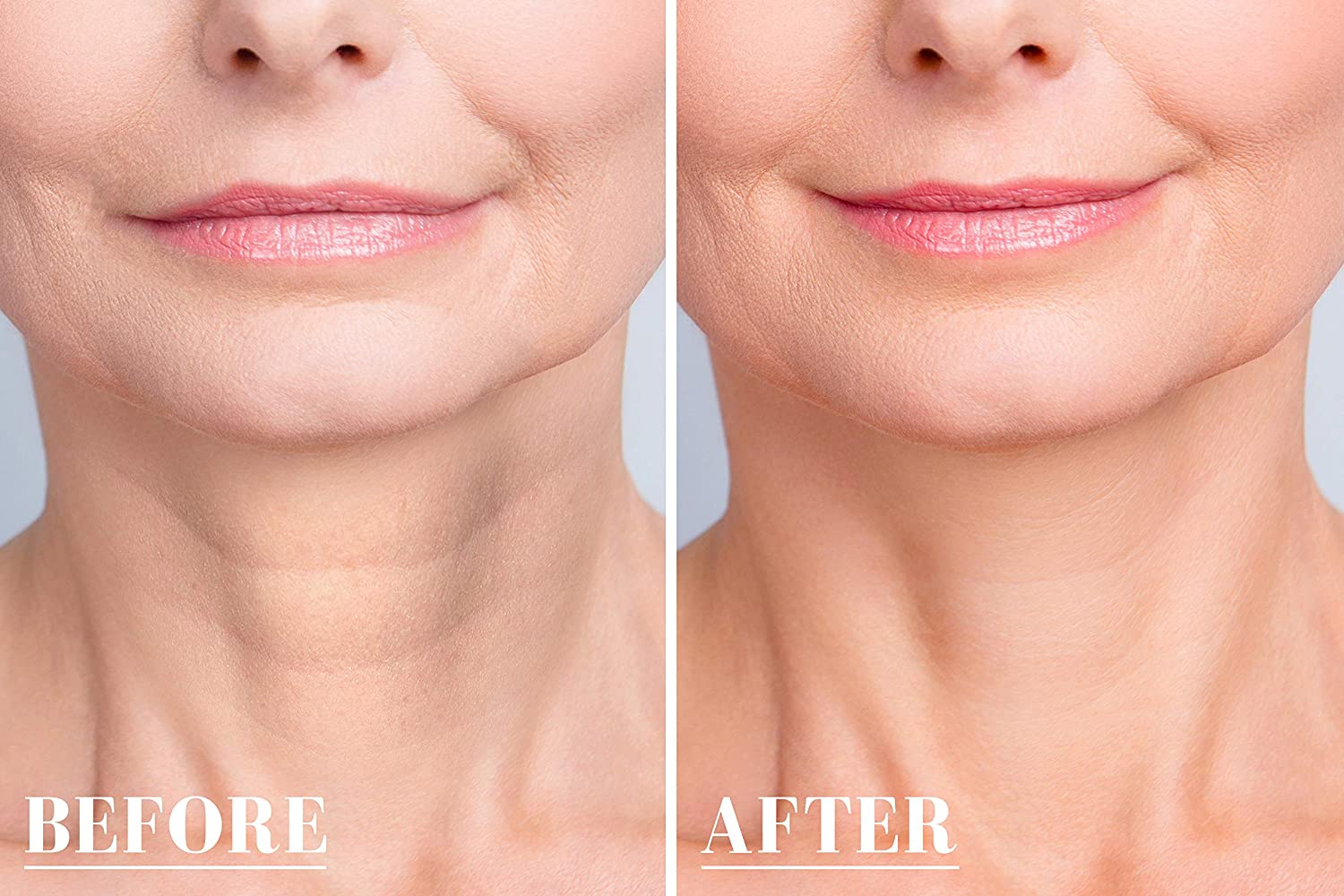 Neck Wrinkle Patches, Advanced Anti Ageing Neck Wrinkle Pads for More Visible Skin Firming & Neck Tightening - Image 3