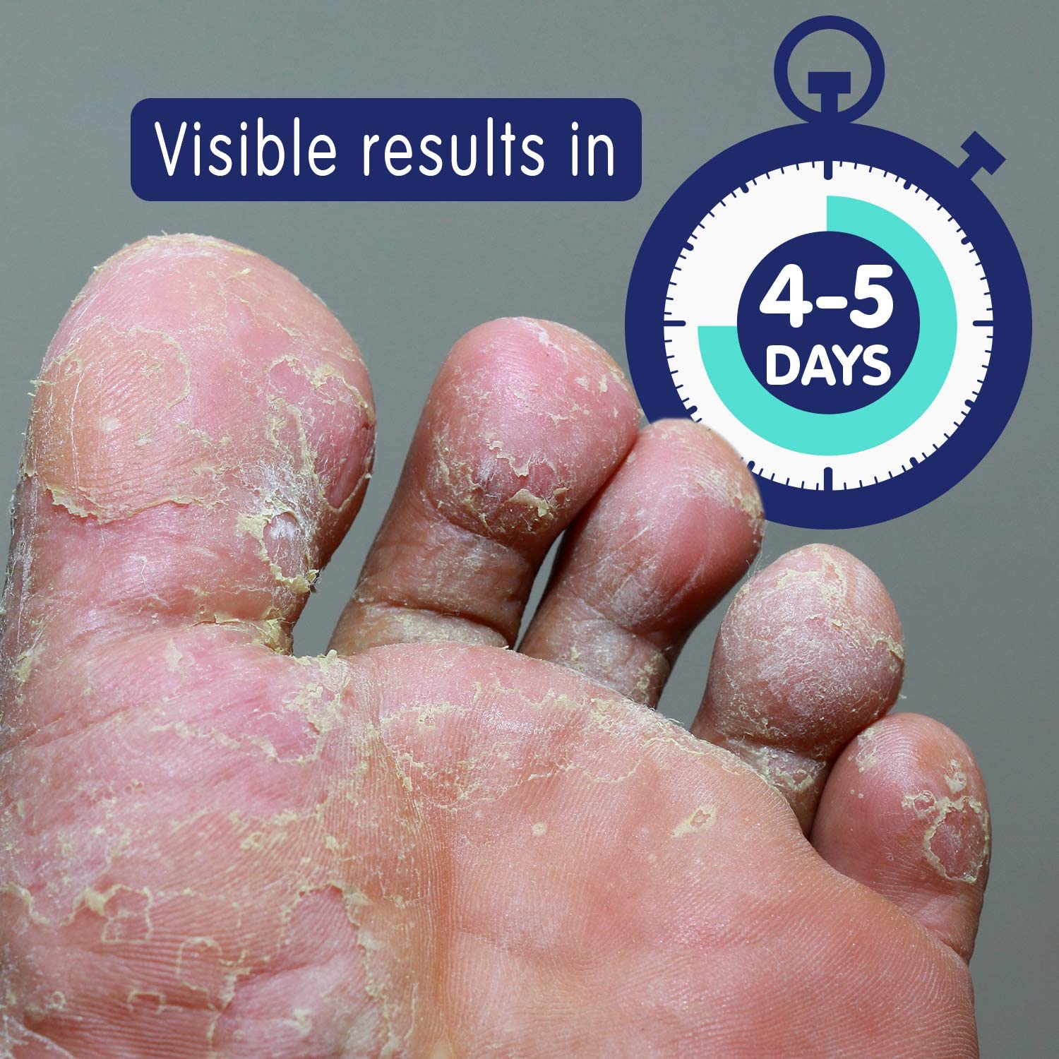 Imperial Feet Foot Cream XL - Natural Foot Care Formula, 75 ML for Cracked and Flaky Skin - Soothes, and Protects Feet Naturally - Image 2