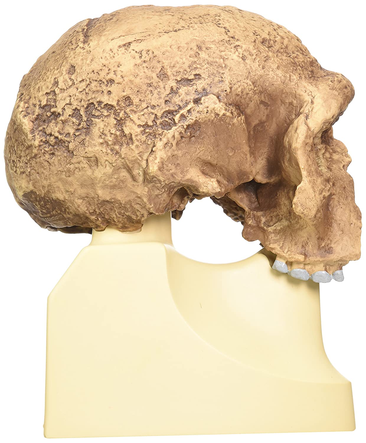 3B Scientific VP753/1 Homo Steinheimensis Skull (Berkhemer, 1936) Model, Replica - Image 4