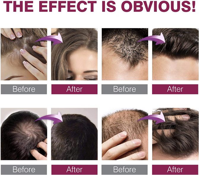 Natural Hair Growth Serum with Hyaluronic Acid Sea Buckthorn Sweet Almond Oil and Collagen for