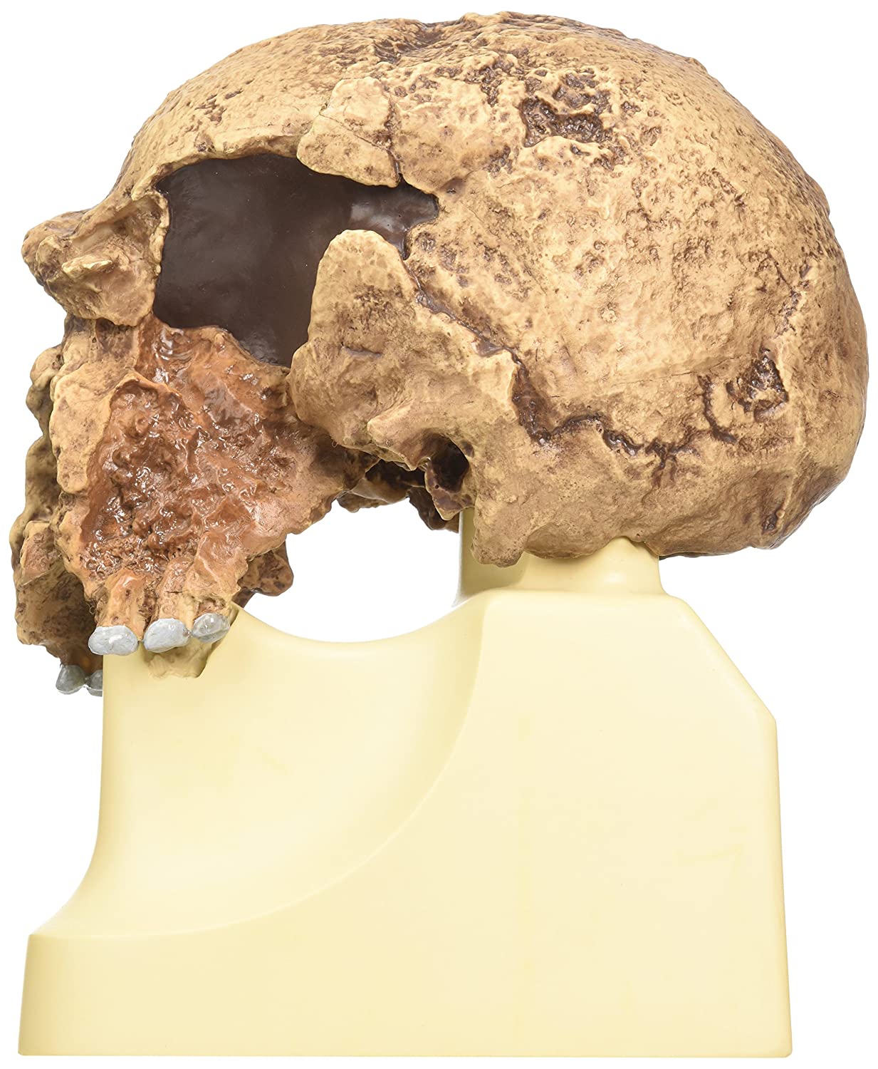 3B Scientific VP753/1 Homo Steinheimensis Skull (Berkhemer, 1936) Model, Replica - Image 2