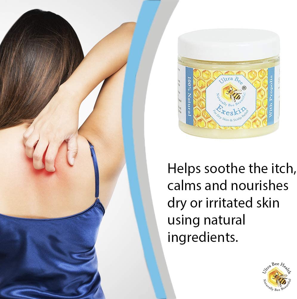 Ultra Bee 100% Natural Exeskin Dry Itchy Skin and Scalp Balm Suitable for People Prone to Eczema Psoriasis,Dermatitis.100ml - Image 3