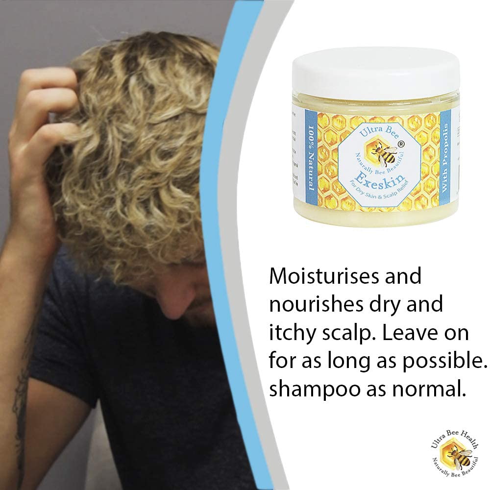 Ultra Bee 100% Natural Exeskin Dry Itchy Skin and Scalp Balm Suitable for People Prone to Eczema Psoriasis,Dermatitis.100ml - Image 4